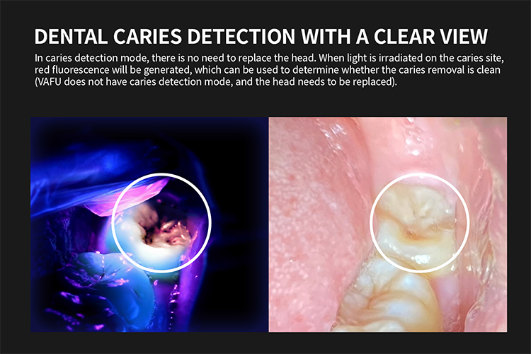CL26 LED Curing Light
